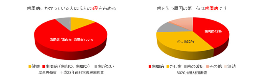 なぜ歯周病の治療が大切なのか？